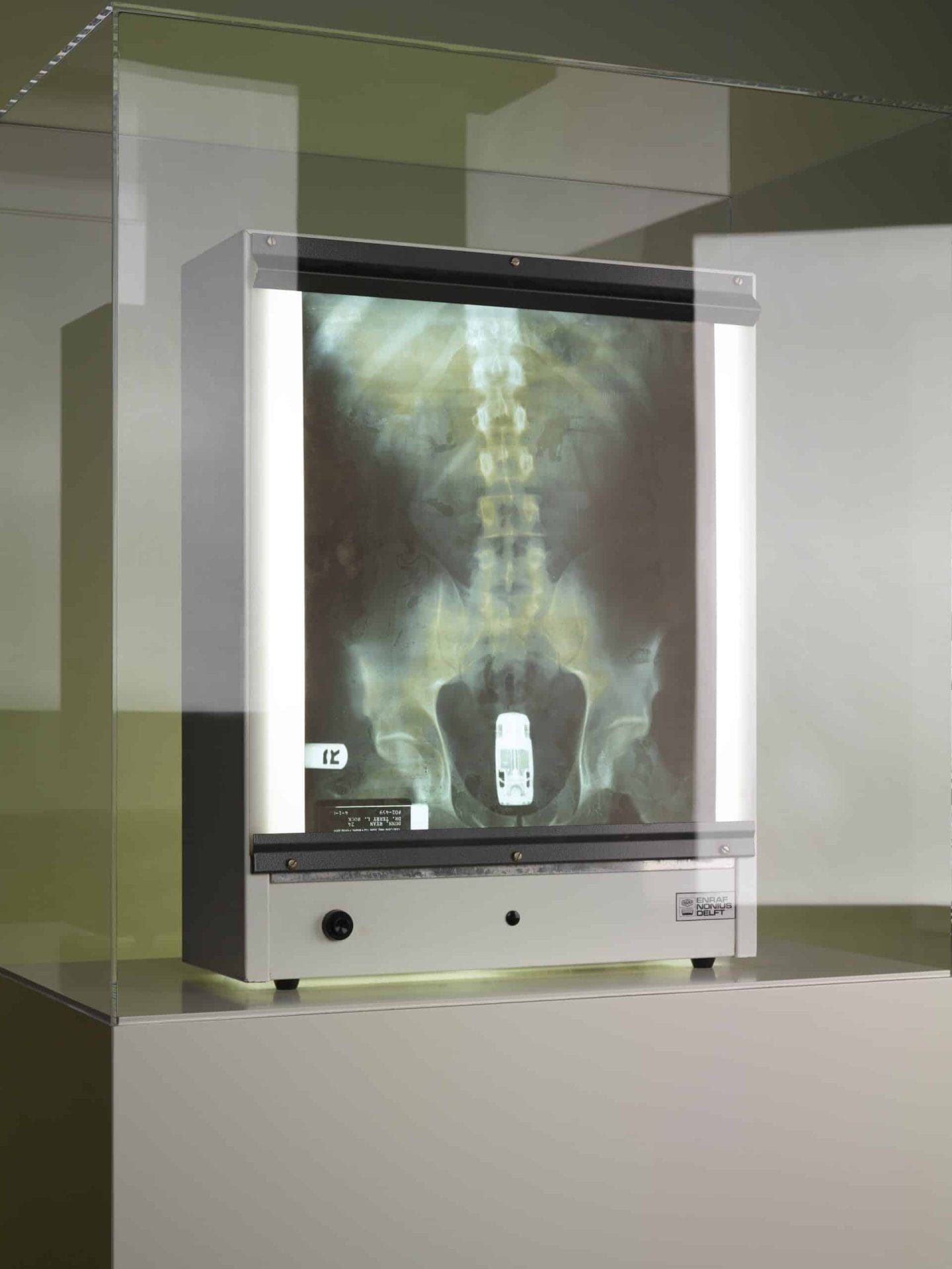 Butt X-Ray uit Jackass