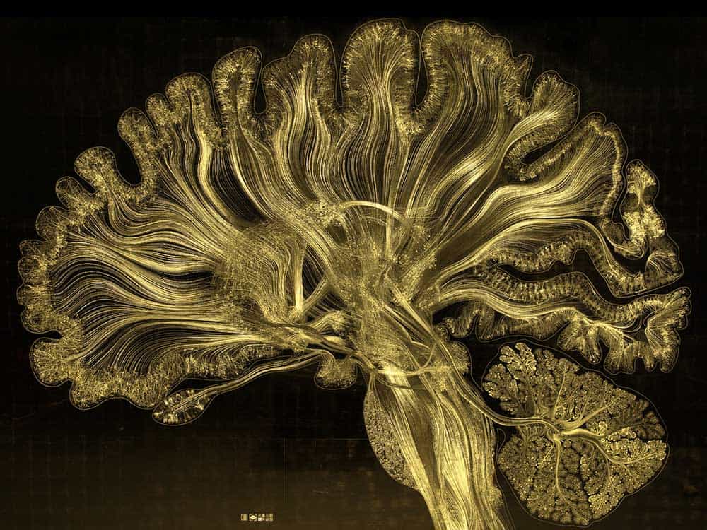 hersenen met bladgoud