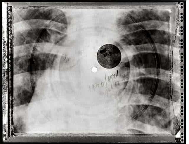 röntgenfoto met muziek